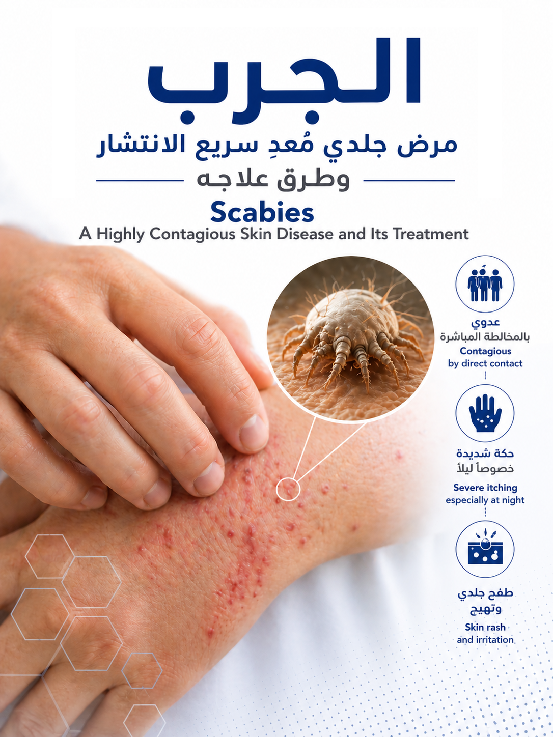 Scabies: A highly contagious skin disease with rapid spread and its treatment methods